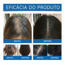 TrendHair Force -  SÉRUM PARA CRESCIMENTO CAPILAR