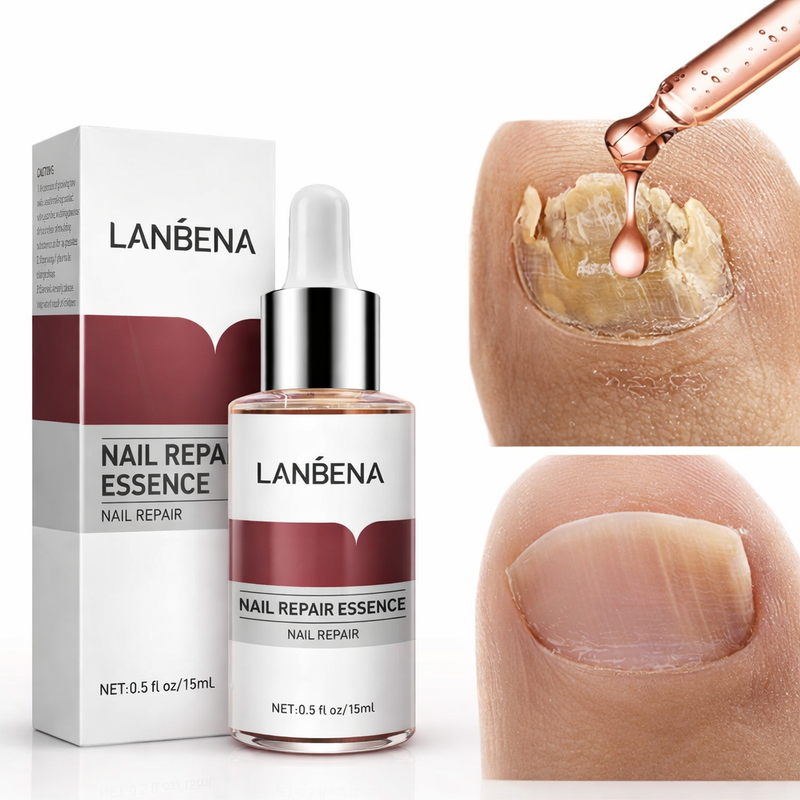 TrendGel Lanbena® - Tratamento para unhas - COMPRE 1 LEVE 2