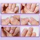 NailCare™ - Tratamento Profissional