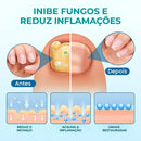 TrendGel Lanbena® - Tratamento para unhas - COMPRE 1 LEVE 2