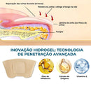 TrendGel Lanbena® - Tratamento para unhas - COMPRE 1 LEVE 2