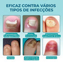 TrendGel Lanbena® - Tratamento para unhas - COMPRE 1 LEVE 2